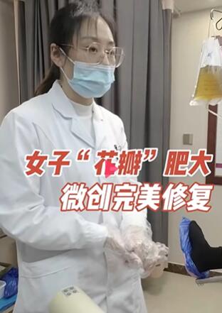女子“花瓣”肥大,微创完美修复