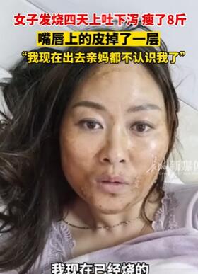 女子发烧四天上吐下泻瘦8斤